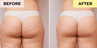 Life's Butter - Anti-Cellulite Cream